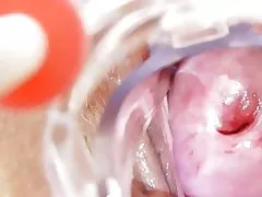 La enfermera cochina se queda isang solas